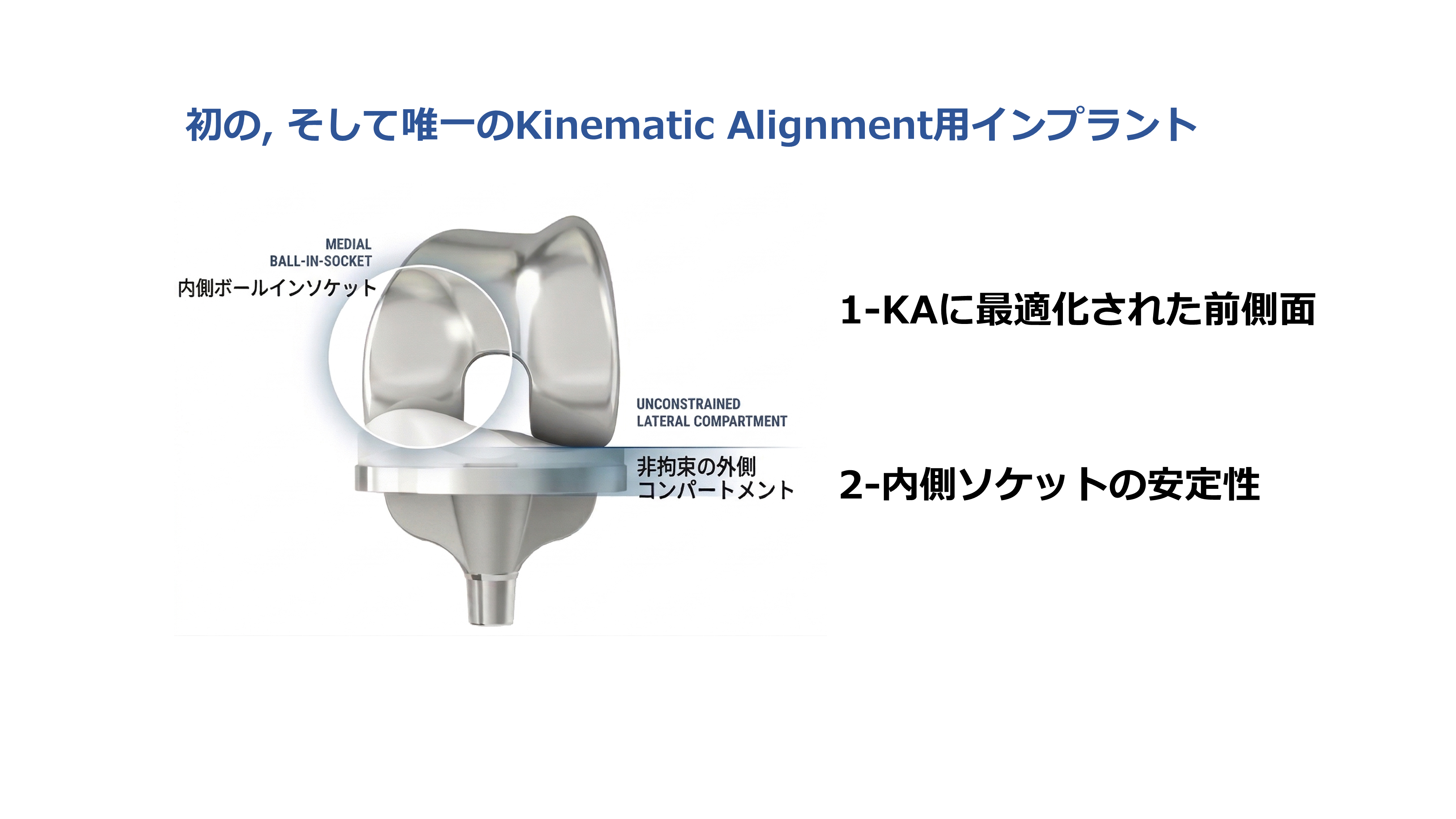 Medacta Spherika 人工膝関節インプラント